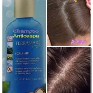 Terramar Scalp Aid Anti-Dandruff Shampoo - Blue